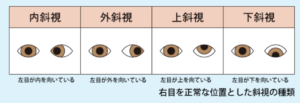 目，絵，画像