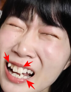尼崎のなつみかんの歯並びが悪い原因は遺伝 歯列矯正はしないの Nori Media